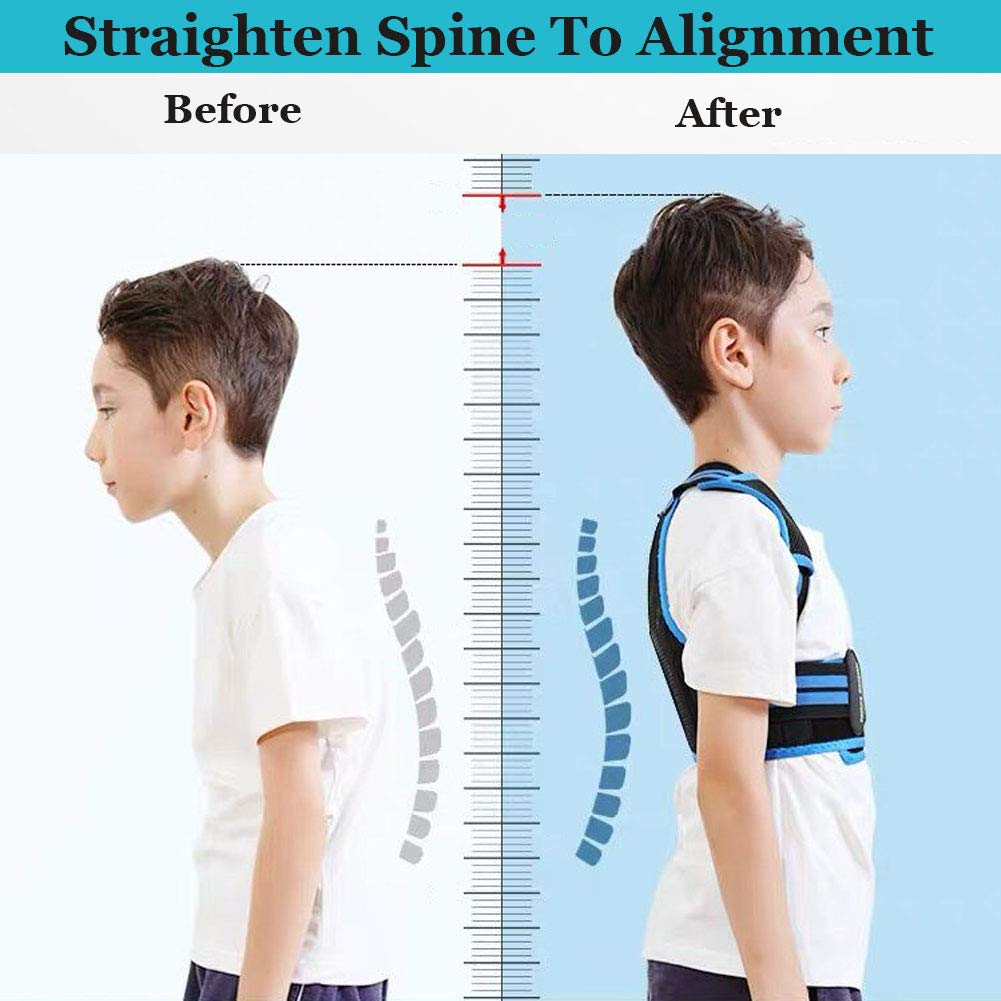 Lexniush Professional Posture Corrector for Kids, Adjustable Upper Back Posture Brace for Teenagers Boys and Girls Under Clothes Spinal Support to Improves Slouch, Prevent Humpback, Relieve Back Pain