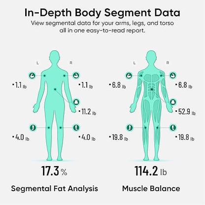 Wyze Smart Scale Ultra BodyScan with Handle – Wi-Fi & Bluetooth Body Composition Scale for Weight, BMI, Body Fat, Muscle Mass, and Segmental Measurement, 400 lbs, Black