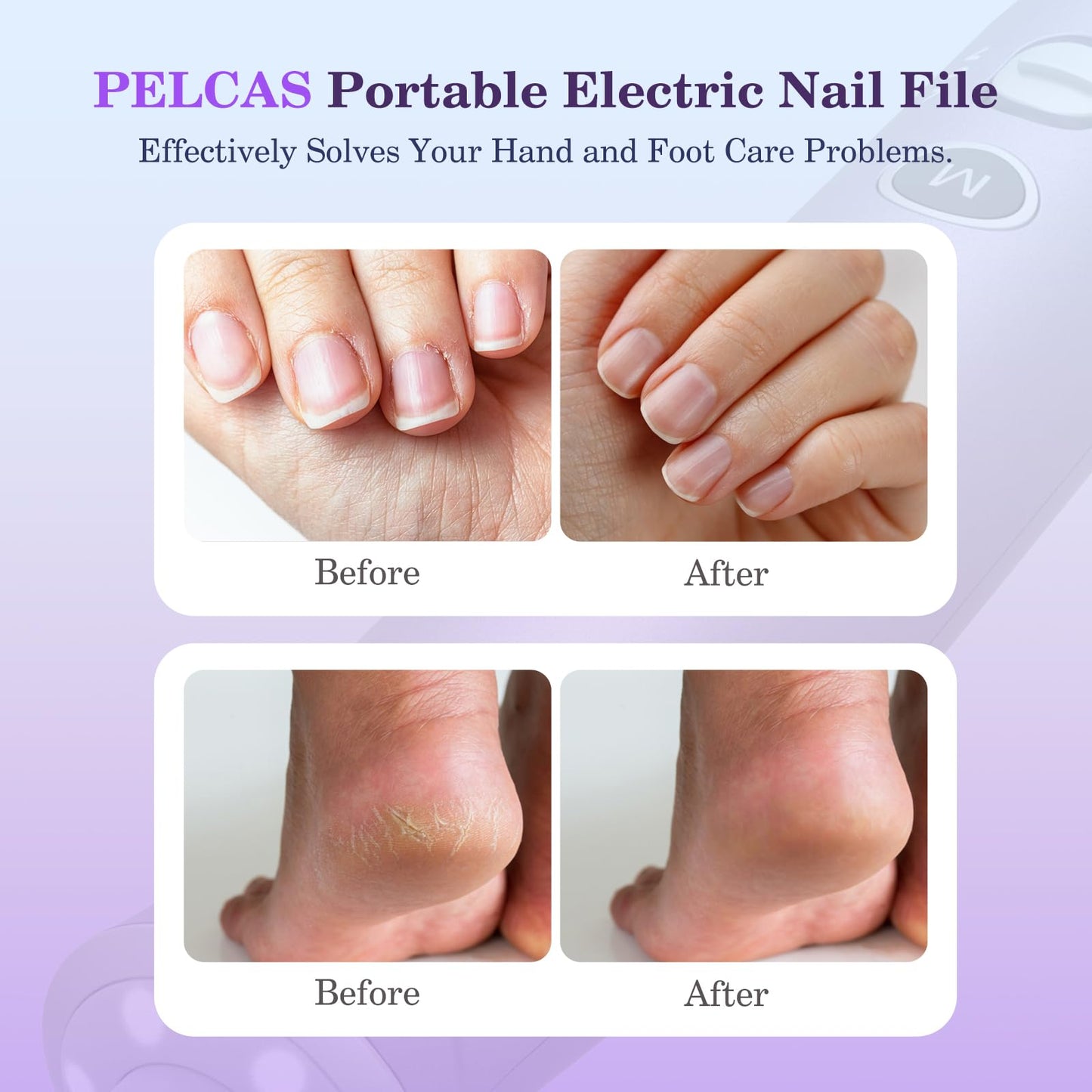 PELCAS Electric Nail Grinder, 10 Speeds Cordless Nail Drill with LED Light, Portable Manicure and Pedicure Kit, Nail File with LCD Screen for Human, Pet, Thick Toenails, Natural & Acrylic Nails Grey