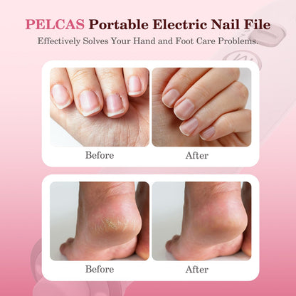 PELCAS Electric Nail Grinder, 10 Speeds Cordless Nail Drill with LED Light, Portable Manicure and Pedicure Kit, Nail File with LCD Screen for Human, Pet, Thick Toenails, Natural & Acrylic Nails Grey