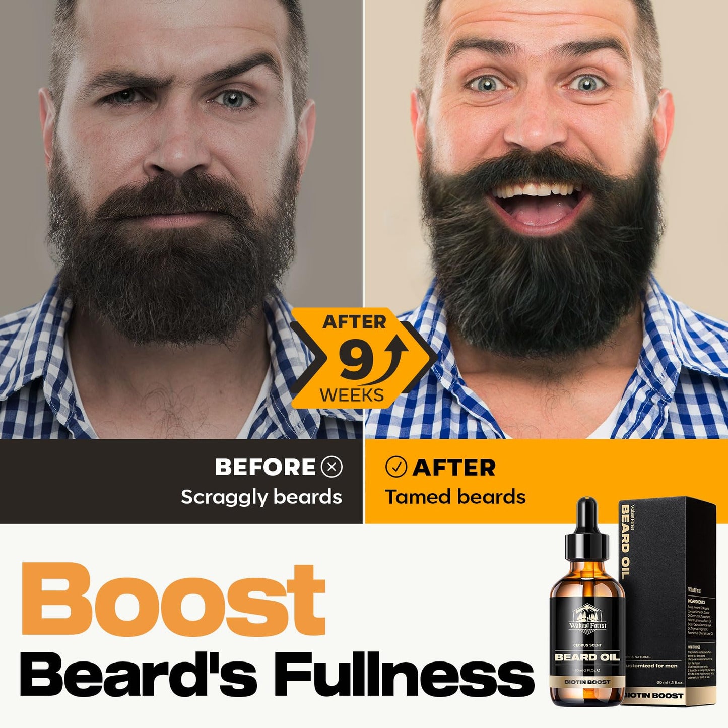 Waking Forest Beard Growth Oil - Biotin Sandalwood Oil with Vitamin E, Rosemary & Castor for Thicker, Softer, Stronger Beards (2oz)