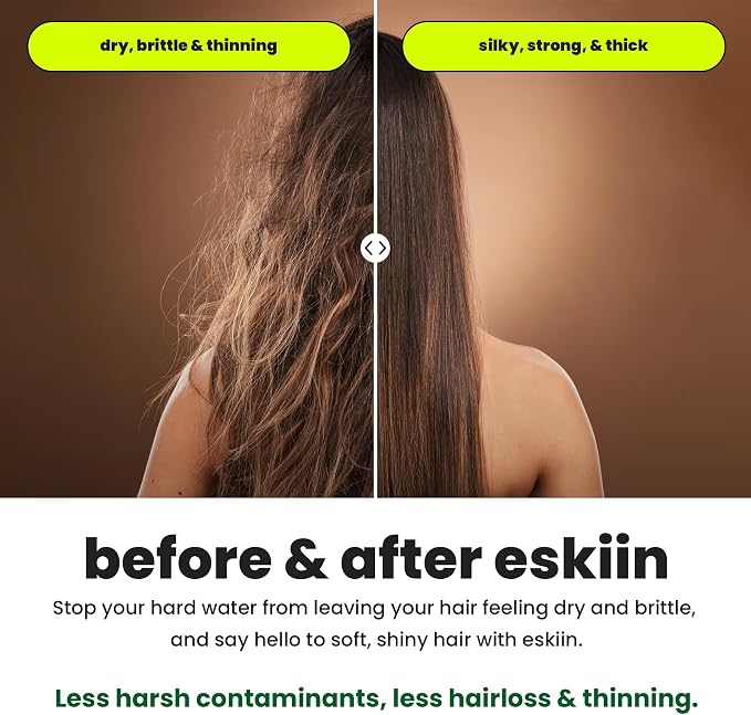 Eskiin Filtered Showerhead - Best Shower Head With Filters For Healthy Hair & Skin - High Pressure Hard Water Softener - Reduce Dandruff, Protect Colored Hair, And Soothe Dry Skin (Brushed Nickel)